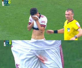 Đồng đội cũ của Neymar gặp chấn thương kinh hoàng trên sân cỏ Đồng đội cũ của Neymar gặp chấn thương kinh hoàng trên sân cỏ