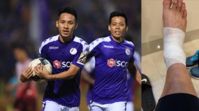 Hà Nội thua thảm hại, HLV Park Hang-seo nhận tin không vui từ Quả Bóng Vàng 2019 Hà Nội thua thảm hại, HLV Park Hang-seo nhận tin không vui từ Quả Bóng Vàng 2019