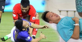 Bác sĩ Thể thao tiết lộ thời gian hồi phục của Hùng Dũng, cần vượt qua ám ảnh chấn thương để trở lại sân cỏ Bác sĩ Thể thao tiết lộ thời gian hồi phục của Hùng Dũng, cần vượt qua ám ảnh chấn thương để trở lại sân cỏ