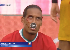 VIDEO: Va chạm nảy lửa, Van Dijk đổ máu trong trận giao hữu của Liverpool VIDEO: Va chạm nảy lửa, Van Dijk đổ máu trong trận giao hữu của Liverpool